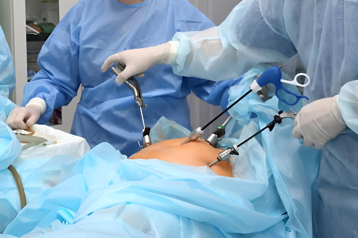 Bariatric Surgery